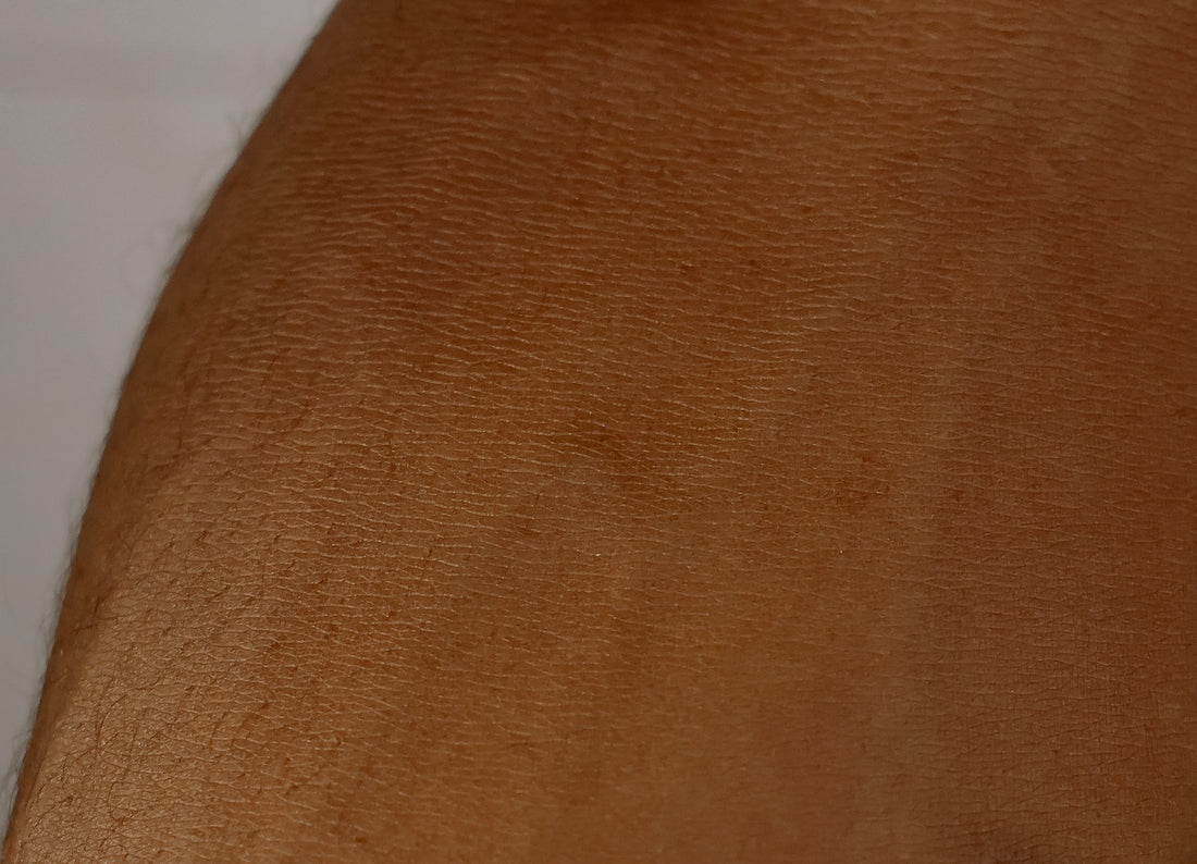 Close up of brown skin with a hint of veins visible, and hair folicles